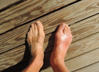 Czy Wkładki na płaskostopie działają? Czy Wkładki na płaskostopie działają?